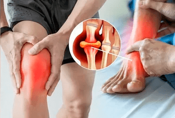 Schema per l'applicazione del gel Icexin sulla zona dell'articolazione del ginocchio e del piede